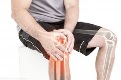 年轻人膝关节炎怎么治疗