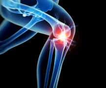 专家解析：膝关节炎的保健措