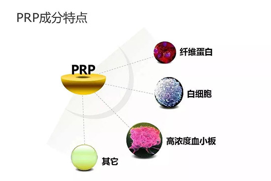 成都西部痛风风湿医院