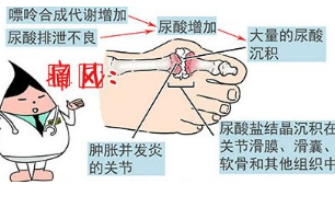 成都西部痛风风湿医院